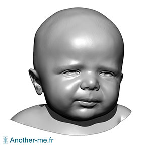 Scan 3D d'une tête de nourrisson de 2 mois